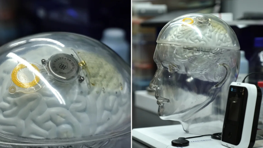 China is catching up to the US in brain tech, rivaling firms like Elon Musk’s Neuralink